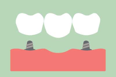 Restorative Dentistry