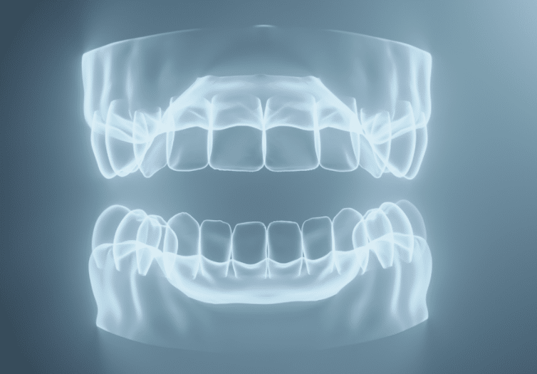 What are the benefits of dental x-rays? | Capozzi Dental